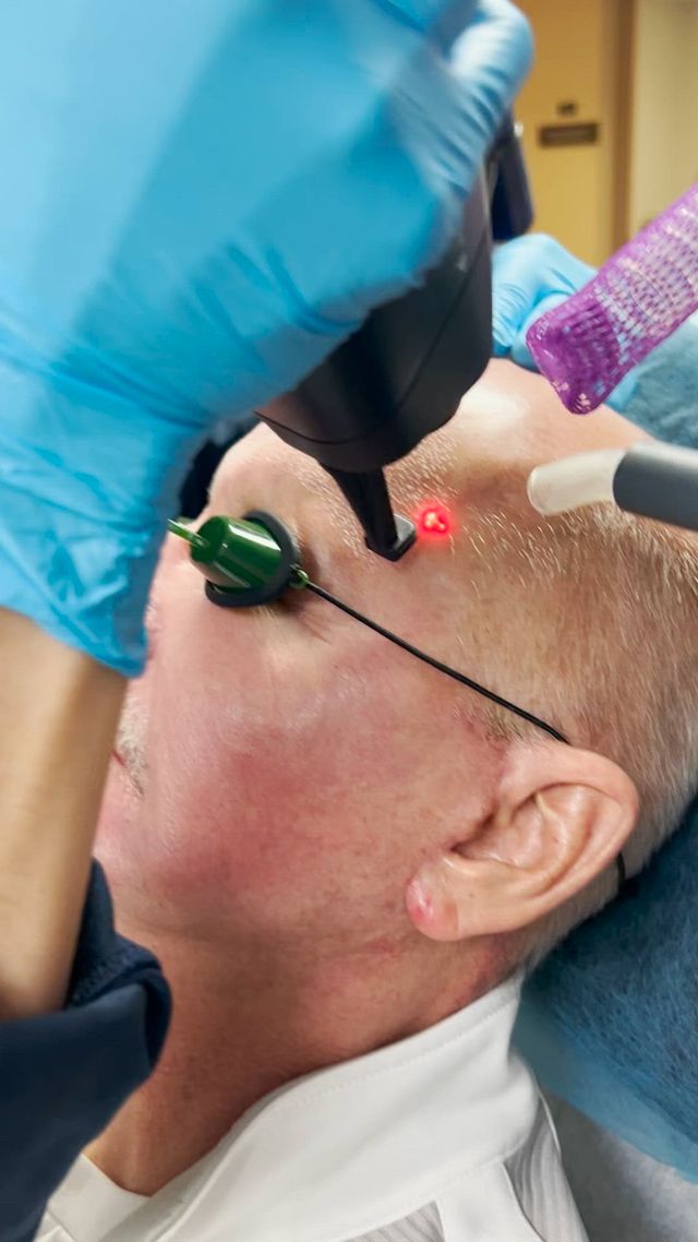 Laser Treatment Services In St. Louis Park and Woodbury